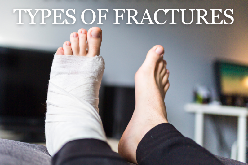 Most Common Types of Fractures